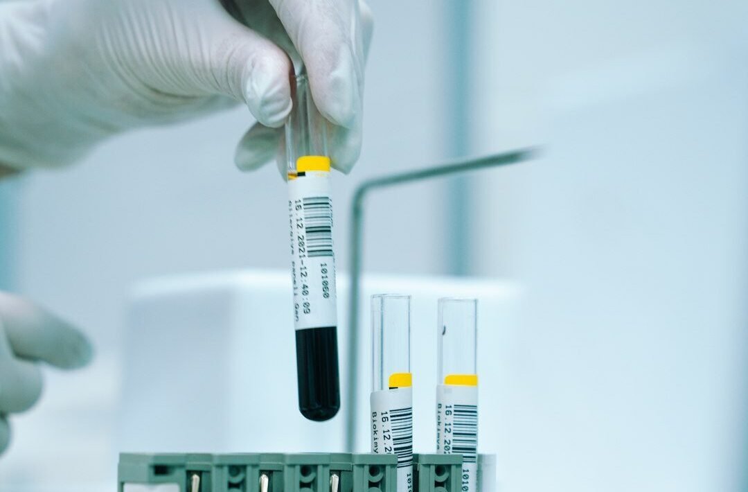 a gloved hand holding a test tube filled with liquid